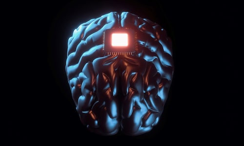 China Enters Clinically Trained Competition with the US for Brain Implants