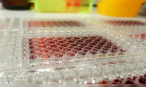 Syngene's Bengaluru facility clears US FDA inspection with VAI classification.
